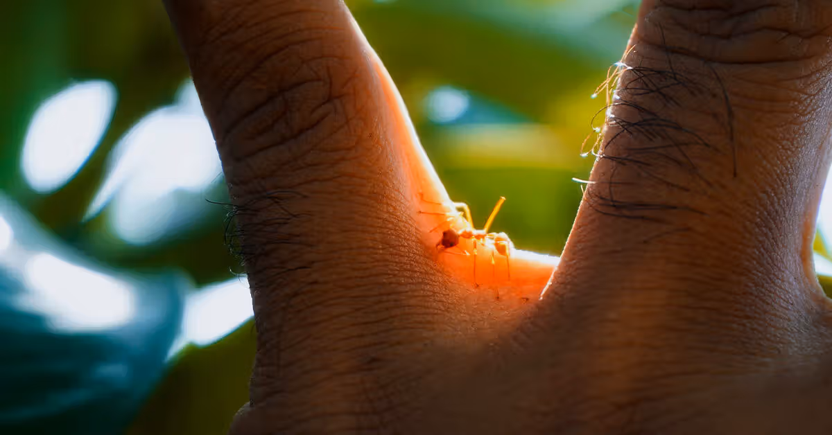 biting ants in vermont